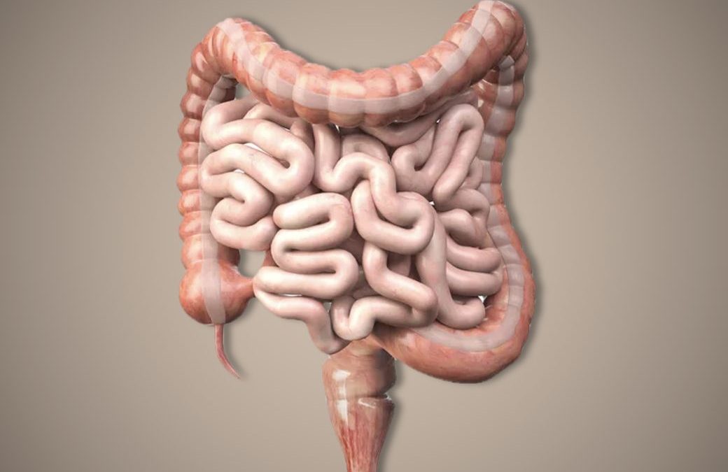 Colitis Ulcerosa